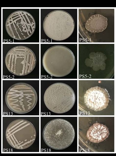 Colour And Morphology Of Streptomyces Spp That Are Isolated From