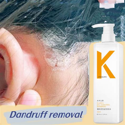 Kono Shampoo Amino Acid Ubat Kelemumur Kepala Syampoo Kelemumur Dan