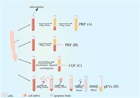 Frontiers Platelet Rich Fibrin As An Autologous Biomaterial For Bone