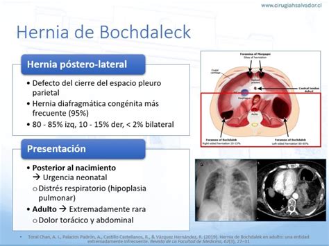 Presentaciones Depto Cirug A Hospital Del Salvador