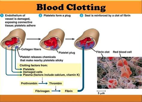 Understand Blood Clotting | Medical Laboratories