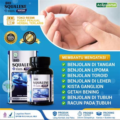 Jual Obat Benjolan Di Tangan Kista Ganglion Obat Penghancur Benjolan Di