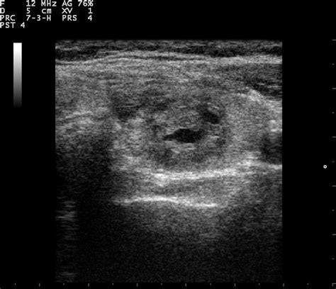 Nuclear Medicine Introduction To Nuclear Imaging Medical Library