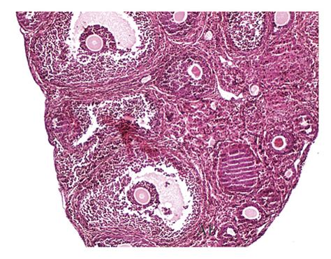 Photomicrographs Of Representative Ovarian Sections From The Different