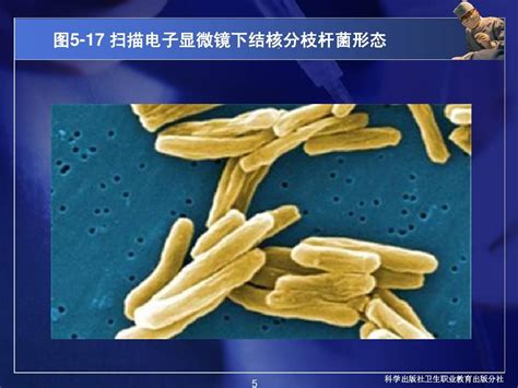 19常见病原菌：分枝杆菌属word文档在线阅读与下载无忧文档