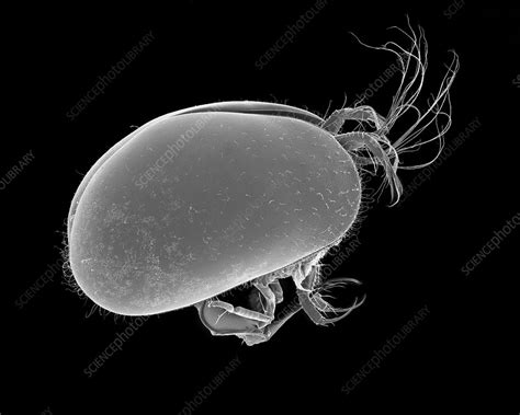 Ostracod Heterocypris Sp Sem Stock Image C037 0485 Science Photo Library