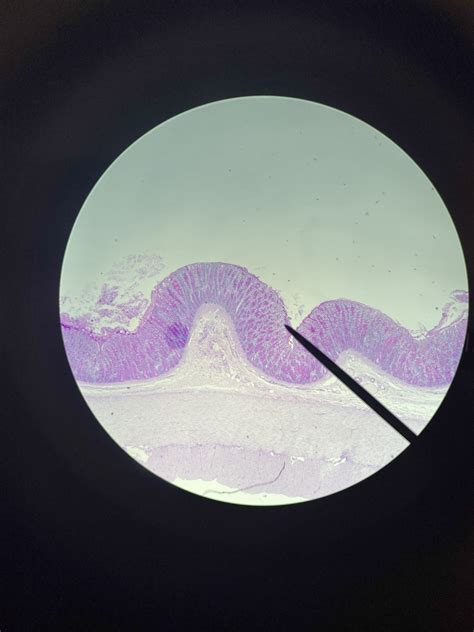 colon Diagram | Quizlet