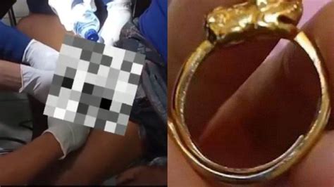 VIRAL Gegara Tersangkut Cincin Alat Vital Pria Asal Demak Ini Alami