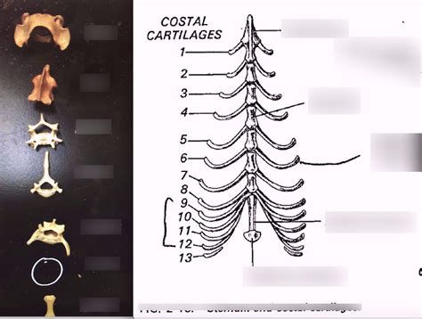 Lab Practical 3 Cat Vertebrae And Sternebrae Diagram Quizlet