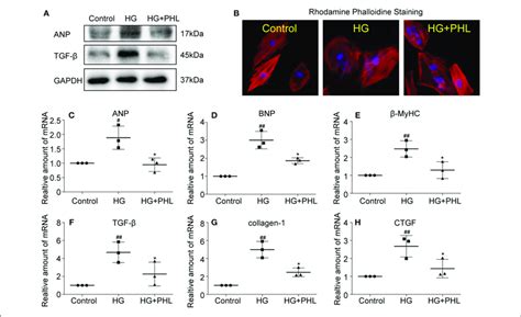 Phl Reduced Hyperglycemia Induced Hypertrophy And Fibrosis In H C