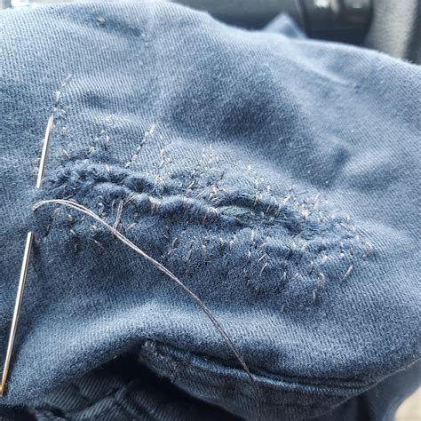 Knee Repair Process : r/Visiblemending