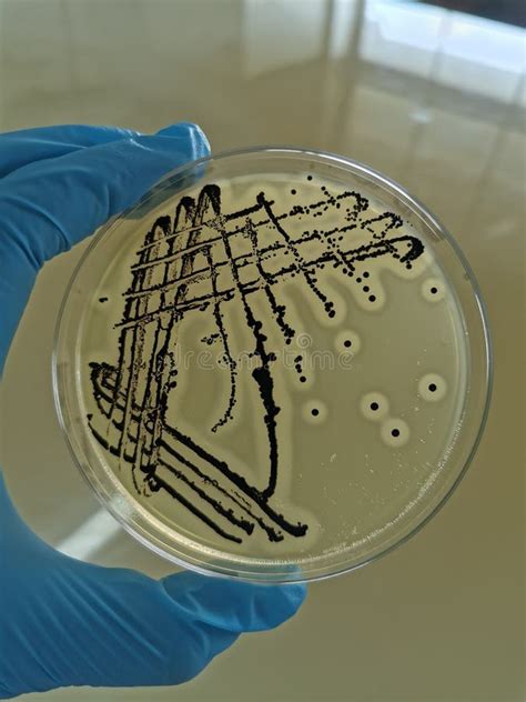 Staphylococcus Aureus En Bairdparker Agar Imagen De Archivo Imagen De