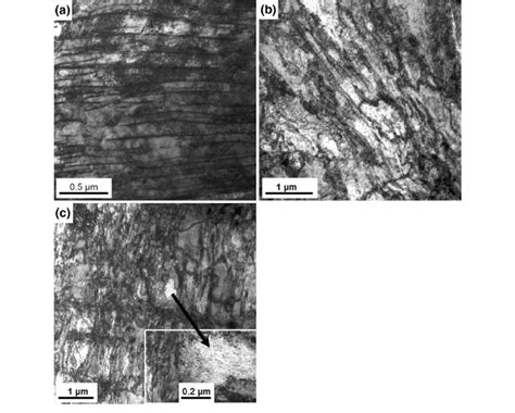 Microstructure Of A Pearlite B Bainite And C Martensite After