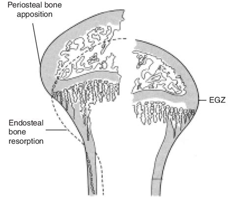 Structural modelling of bone metaphysis during longitudinal growth. A... | Download Scientific ...