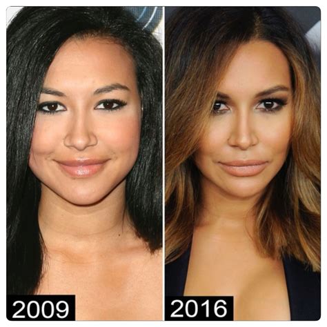 Plastic Surgery Nightmare? Lama Hasan's Transformation Story