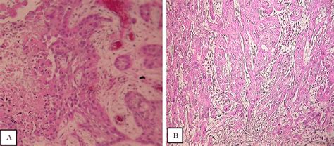 Coupe Histologique Apr S Coloration H Matoxyline Osine Safran Hes