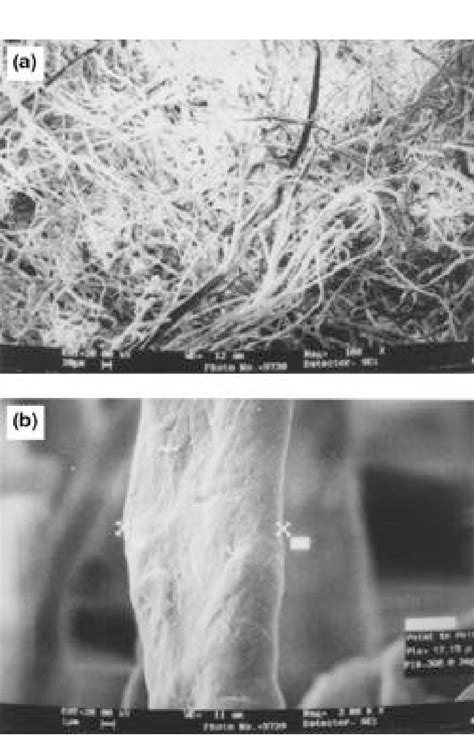 Scanning electron micrographs of BC (a) (×100) and (b) (×3000 ... 