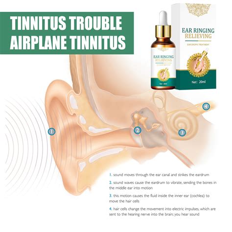 Siquannnn Ear Ringing Relieving Ear Drops Treatmentss Tinnitus Ear