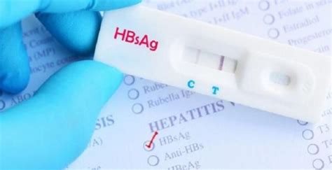 Mengenal Tes Hbsag Adalah Untuk Deteksi Hepatitis B