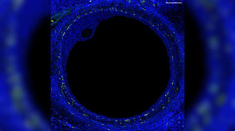 St Atlas Of Human Ovaries Could Lead To Fertility Breakthrough