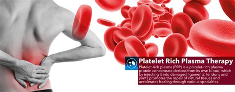 Platelet Rich Plasma Therapy - UR Care