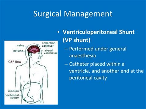 Normal Pressure Hydrocephalus