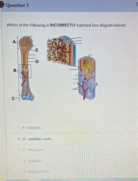 Solved Which of the following is INCORRECTLY matched (see | Chegg.com