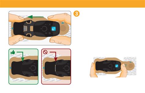 Preventice Solutions Bodyguardian Mini Plus Medical Equipment Patient