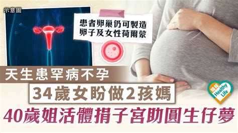 姐妹情深｜天生患罕病不孕 34歲女盼做2孩媽 40歲姐姐活體捐子宮助圓生仔夢 晴報 健康 女性疾病 D230827