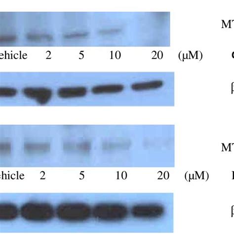 Western Blot Analysis Of MT1 MMP Expression After Treatment With