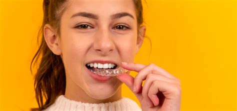 What To Expect During Your Invisalign Treatment A Step By Step Guide