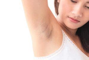 How To Whiten Armpits Ways To Have Fairer Underarms In Singapore