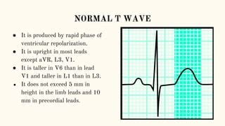 Abnormalities of t wave | PPT