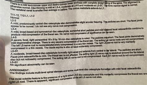 MRI Results of my Lumbar Spine : r/backpain