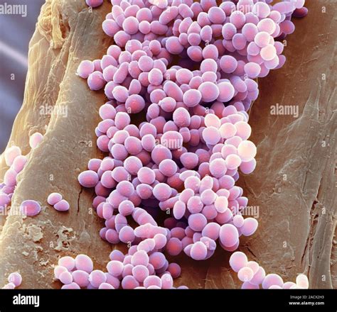 Lactococcus Lactis Bacteria Coloured Scanning Electron Micrograph Sem