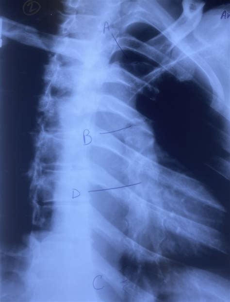 RAO STERNUM 2 Diagram Quizlet