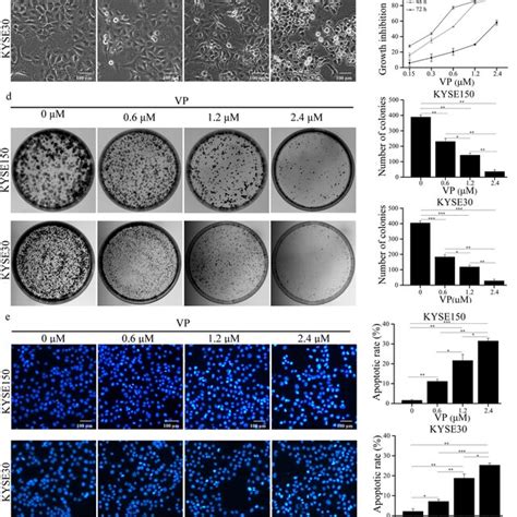 Vp Inhibited Escc Cell Growth And Induced Cell Apoptosis A