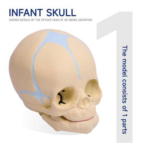Molding Of Fetal Head 4