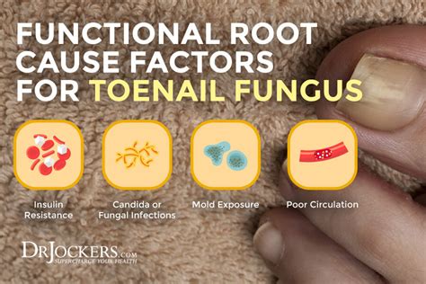 Toenail Fungus Symptoms Causes And Support Strategies