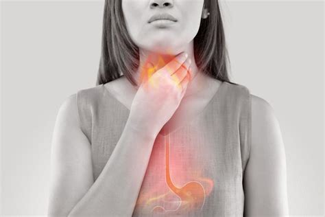 Queimaçao No Estomago E Garganta - Queimação na garganta por refluxo: Sintomas, tratamento e remédios