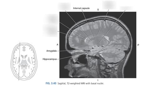 Diagram Of Sagittal MRI Basal Nuclei Quizlet