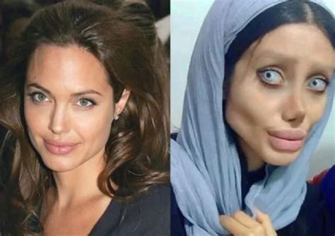 Plastic Surgery Gone Wrong Woman 19 Underwent 50 Surgeries To Look