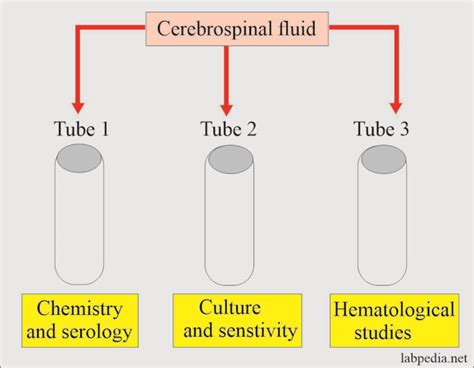 Cerebrospinal Fluid Analysis Part 2 CSF Complete Examination