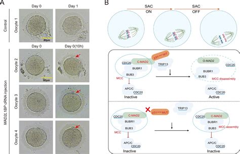 Biallelic Variants In Mad2l1bp P31comet Cause Female Infertility Characterized By Oocyte