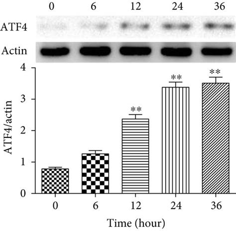 Hcy Induced The Expression Of Er Stress Related Proteins In Huvec In A