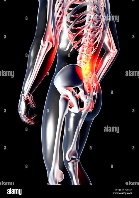 Anatomy - Back Pain Stock Photo - Alamy