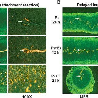 In Situ Hybridization Of Lif Lifr And Gp Mrnas At The Time Of