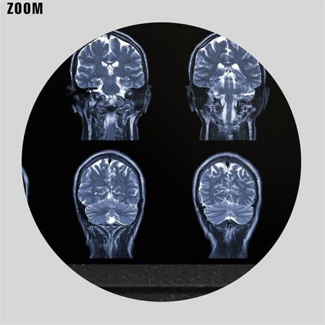 Printable MRI X-Ray Human Brain - medical radiology poster