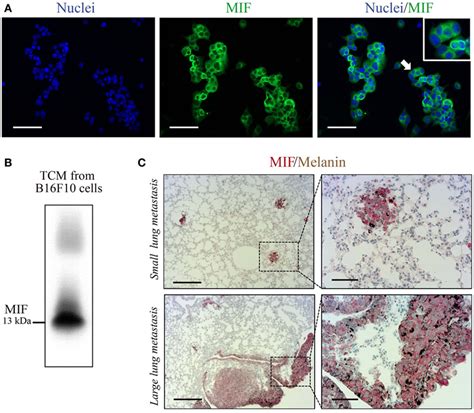 Frontiers Blockade Of Mifcd74 Signalling On Macrophages And