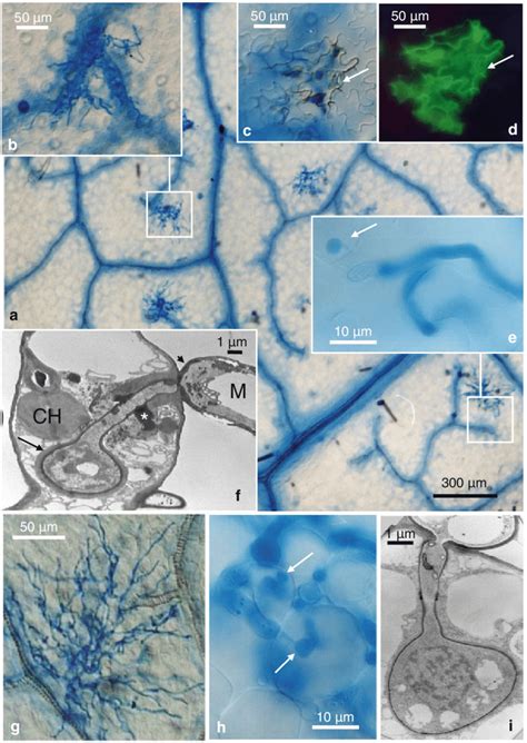 Light Trypan Blue Staining And Electron Microscopy Ultrathin